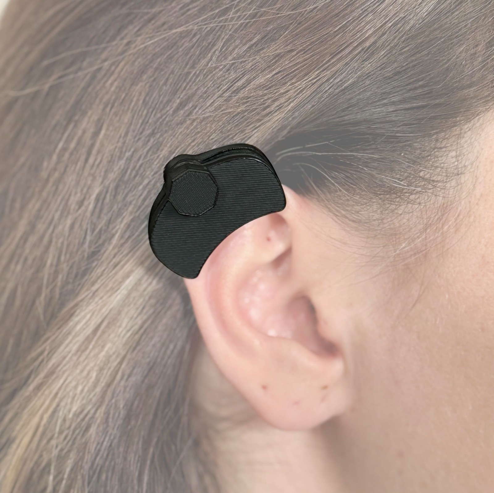 Earring Scar Keloid Medical Compression Pressure Surgery Treatment Helix OpenBox