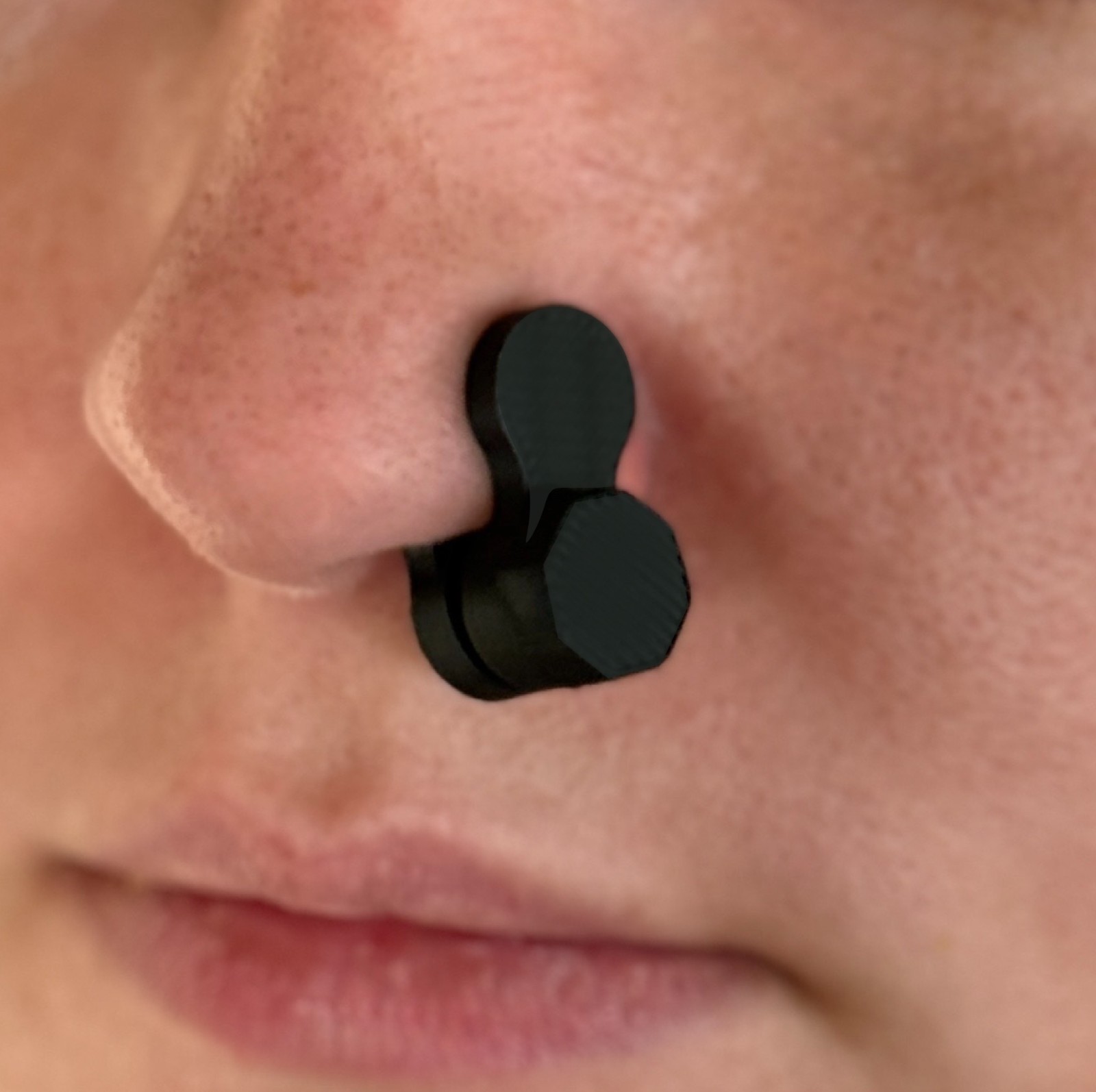 Nose Scar Keloid Medical Compression Earring Pressure Surgery Treatment Mini