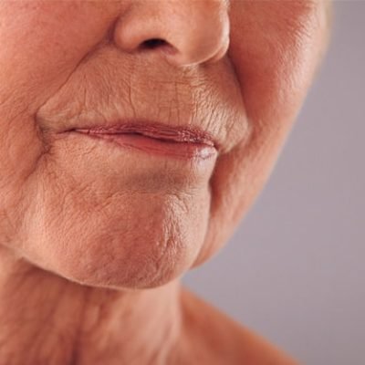 Como-combater-a-flacidez-facial-sem-cirurgia.jpg